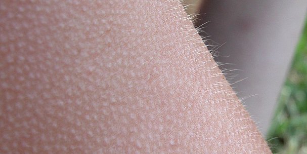 Angedacht - Gänsehaut